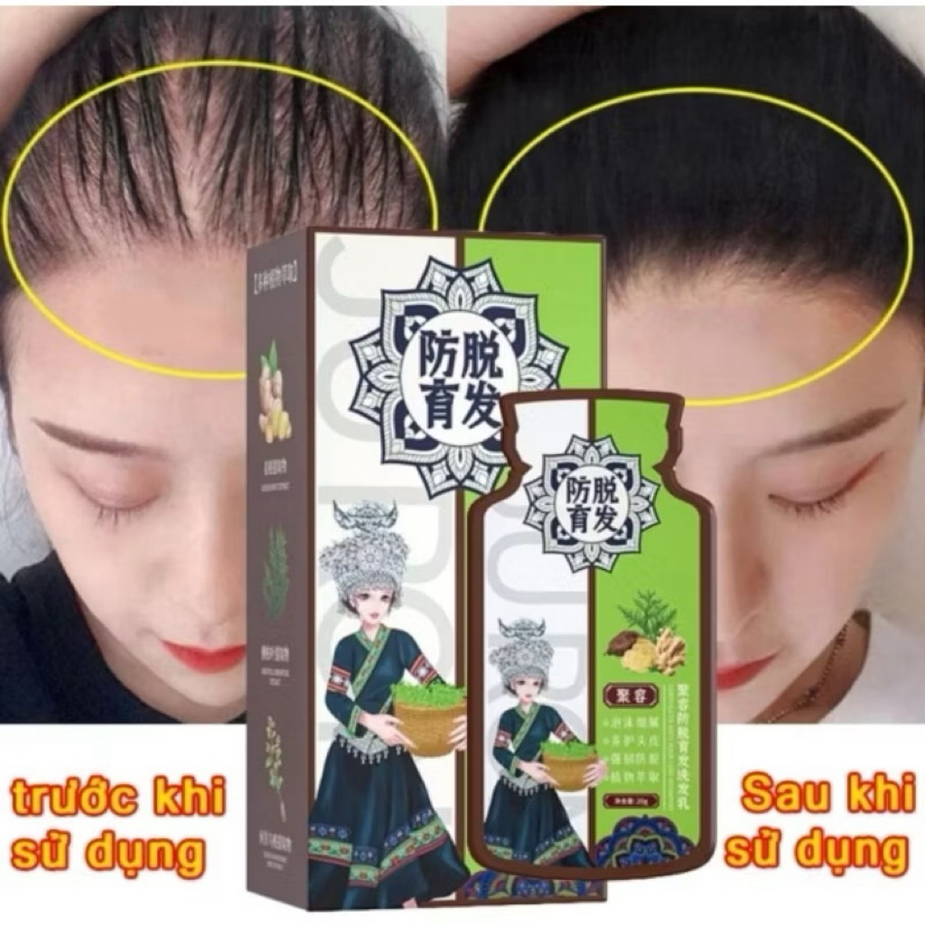 (Hộp 10 gói) Dầu Gội Chống Rụng Tóc Và Kích Thích Mọc Tóc Chiết xuất củ gừng giúp tóc chắc khoẻ Kiểm soát dầu