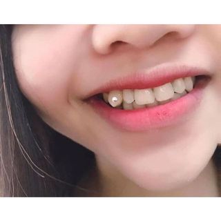 Combo 30 viên đá đính răng tại nhà TẶNG KÈM keo và bút đính đá