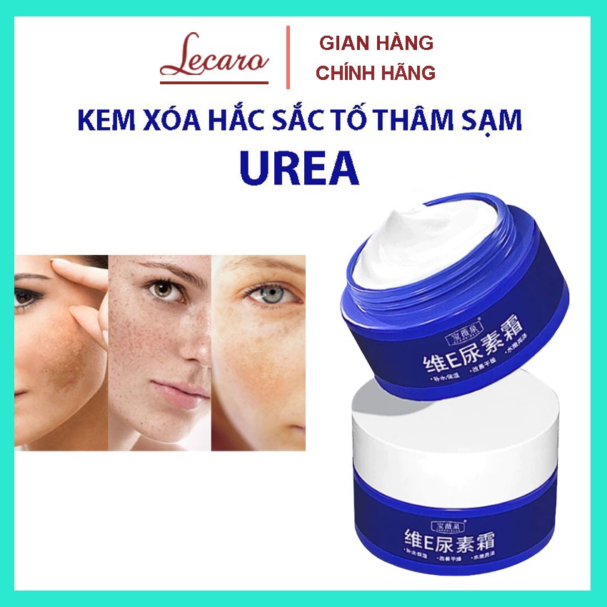 Kem Mờ Nám Tàn Nhang UREA - Kem Dưỡng Ẩm UREA Dưỡng Trắng, Mờ Nám, Đồi Mồi, Xóa Nhăn, Chống Lão Hóa 