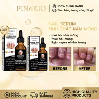  EELHOE Tinh chất nấm móng Serum Tẩy Nấm Móng Tay Chân Loại Bỏ Nấm Móng Dưỡng Móng Phục Hồi Móng 