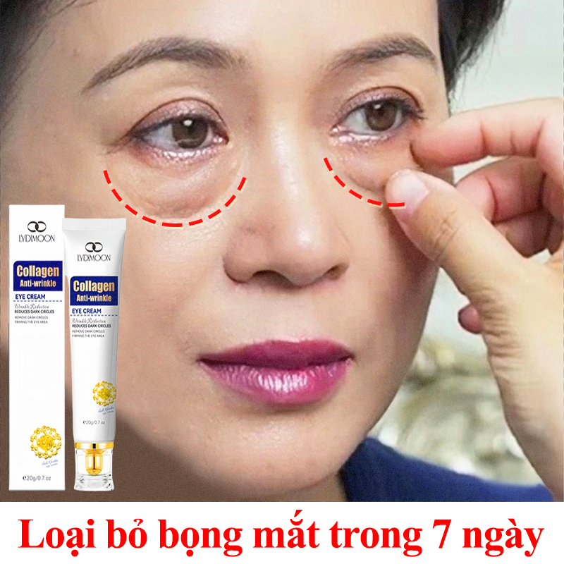 Kem dưỡng mắt collagen Kem dưỡng quầng thâm Loại bỏ bọng mắt, quầng thâm và nếp nhăn quanh mắt 20g