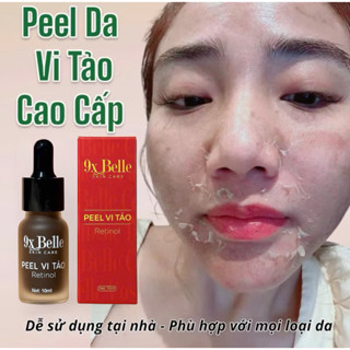 PEEL DA MẶT VI TẢO CAO CẤP - tẩy da chết - giảm mụn thâm mờ nám tàn nhang - thay da sinh học peel lột da mặt retinol
