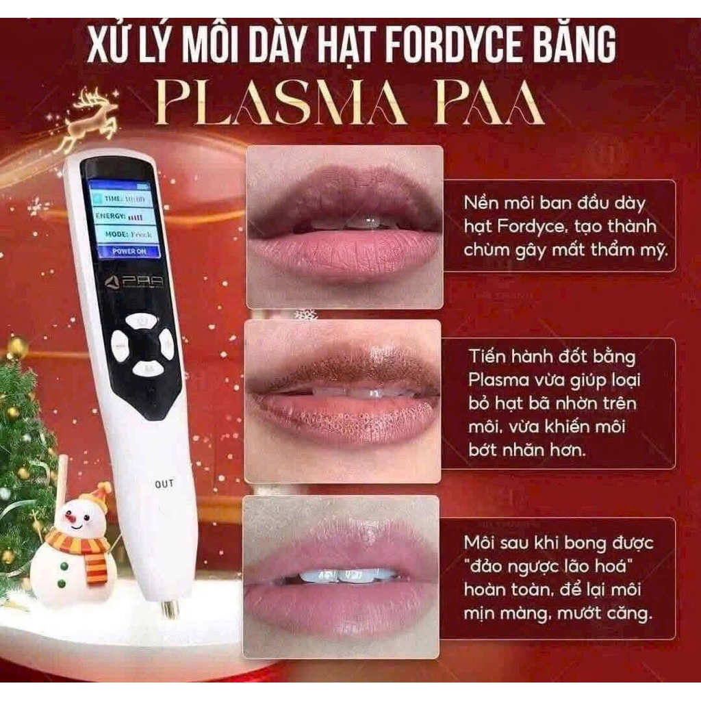 MÁY PLASMA LẠNH PPA Xử Lý Nốt Ruồi Mụn Fordyce Nhấn Mí Tàn Nhan ĐA NĂNG BIOMASER