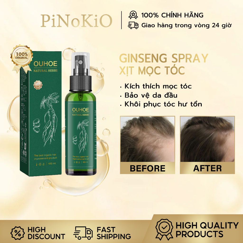 Ouhoe Xịt Mọc Tóc Thảo Dược Tinh Chất Mọc Tóc Giúp Dưỡng Tóc Mọc Tóc Con Ngăn rụng tóc