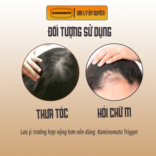 Serum Mọc Tóc Dưỡng Da Đầu Nuôi Dưỡng Nang Tóc Chắc Khỏe Dành Cho Tóc Rụng Mỏng Yếu Kaminomoto Gold 150ml