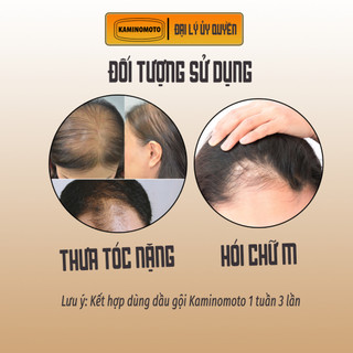 Serum Mọc Tóc Dưỡng Da Đầu Nuôi Dưỡng Nang Tóc Chắc Khỏe Dành Cho Tóc Rụng Mỏng Yếu Kaminomoto Trigger 180ml