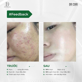 Tế bào gốc mụn Dr Pluscell_ Dr cori 1 lọ 8ml