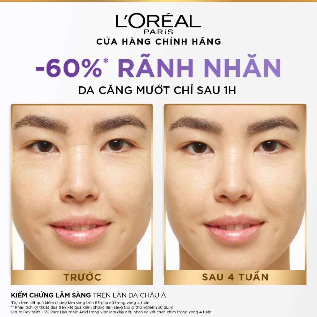 Bộ Serum Cấp Ẩm Sáng Da 30ml, 7.5ml và kem dưỡng 15ml siêu cấp ẩm giảm nếp nhăn L'Oreal Paris Revitalift Hyaluronic Acid | BigBuy360 - bigbuy360.vn