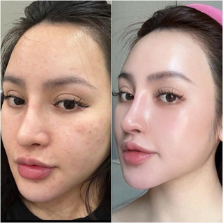 Sữa rửa mặt dược liệu ( giảm nhờn, mụn, sạch sâu, loại bỏ da chết, da mịn sáng hồng) phù hợp mọi loại nha. 60gr