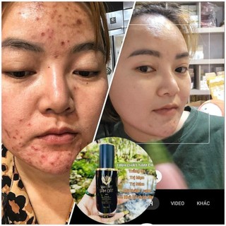 Tinh Chất Sâm Đất Dr Cell 50ml tái tạo da hỗ trợ giảm mụn hỗ trợ mờ thâm nám