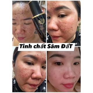 Tinh Chất Sâm Đất Dr Cell 50ml tái tạo da hỗ trợ giảm mụn hỗ trợ mờ thâm nám