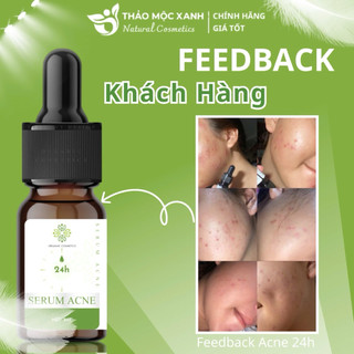 Serum Acne 24h ngừa mụn 5ml