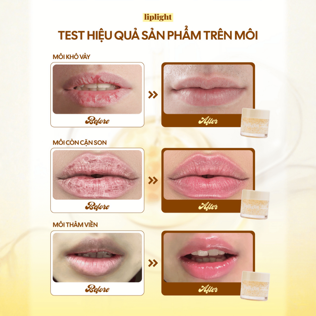 Gel tẩy tế bào chết môi dành cho môi nhạy cảm, hỗ trợ giảm thâm sần, hồng môi Liplight peeling gel 25g | BigBuy360 - bigbuy360.vn