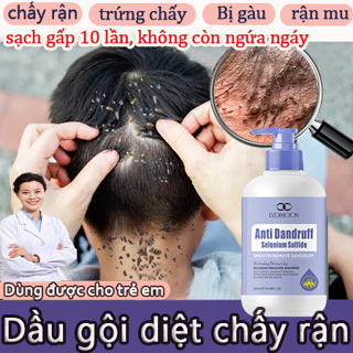  dầu gội diệt chấy dầu gội sạch gàu  300ml giảm ngứa nhanh chóng  làm sạch sâu da đầu diệt chấy diệt bọ ve 