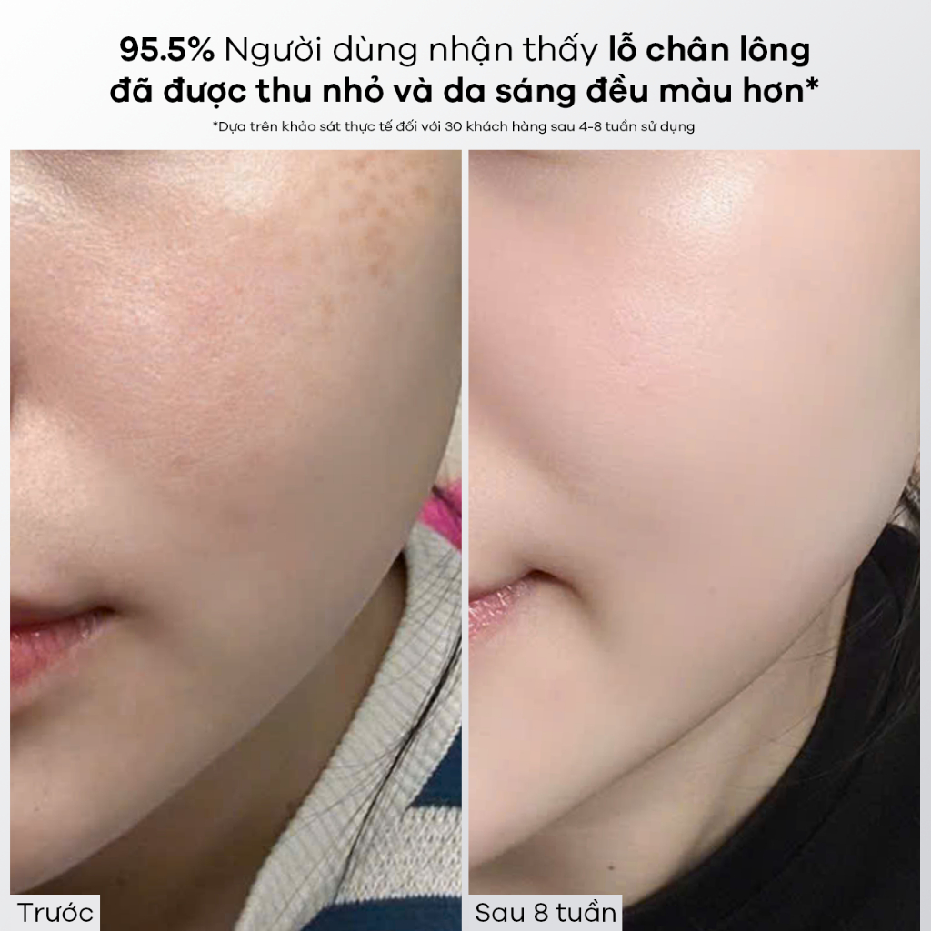 Tinh chất dưỡng trắng và mờ thâm Anodin Niacinamide 10 Plus