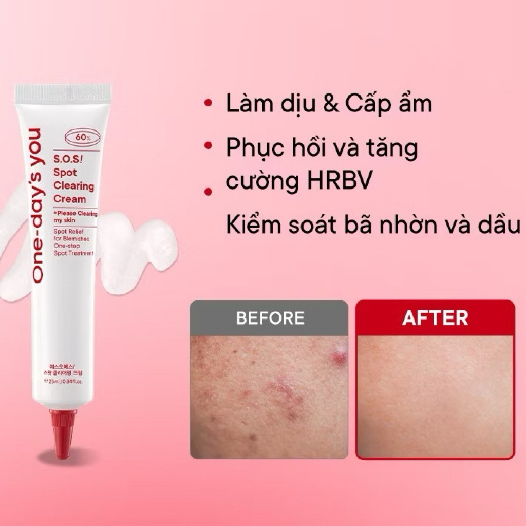 Kem chấm mu.n ONE DAYS YOU S.O.S Spot Clearing Cream làm dịu da, giảm mụn, phục hồi da 25ml
