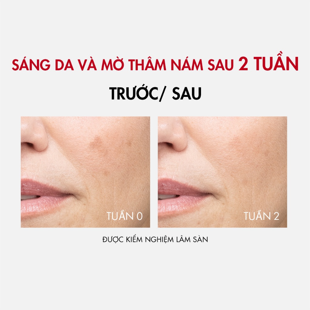 [Thế hệ mới] Serum Vichy B3 sáng da +98% sau 2 tuần nhờ Melasyl + Tranexamic Acid, giảm đốm nâu thâm nám toàn diện, 30ml | BigBuy360 - bigbuy360.vn