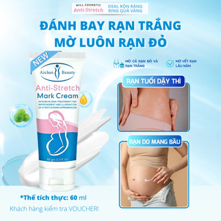 Kem Mờ Rạn Da Anti Strectch Dưỡng Ẩm, Hỗ Trợ Cải Thiện Thâm, Rạn Da Cho Mẹ Bầu Sau Sinh Và Tuổi Dậy Thì