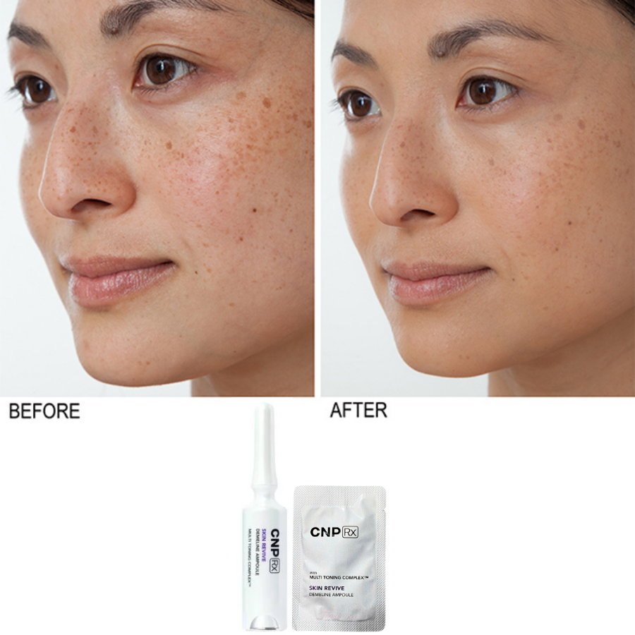 [Top 1 bán chạy] Combo 10 Gói sample Tinh chất CNP RX hủy nám, tàn nhang Skin Revive Demeline Ampoule - AB AUTHENTIC | BigBuy360 - bigbuy360.vn