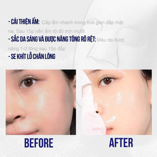 [ Top 1 bán chạy] Mặt nạ giấy dưỡng sáng, cấp ẩm và làm dịu da CNP Laboratory Ampule Mask 25ml - AB AUTHENTIC