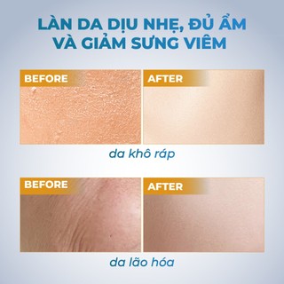 Mặt Nạ Lụa Trẻ Hoá Cấp Ẩm Da NARA Nhân Sâm Tổ Yến