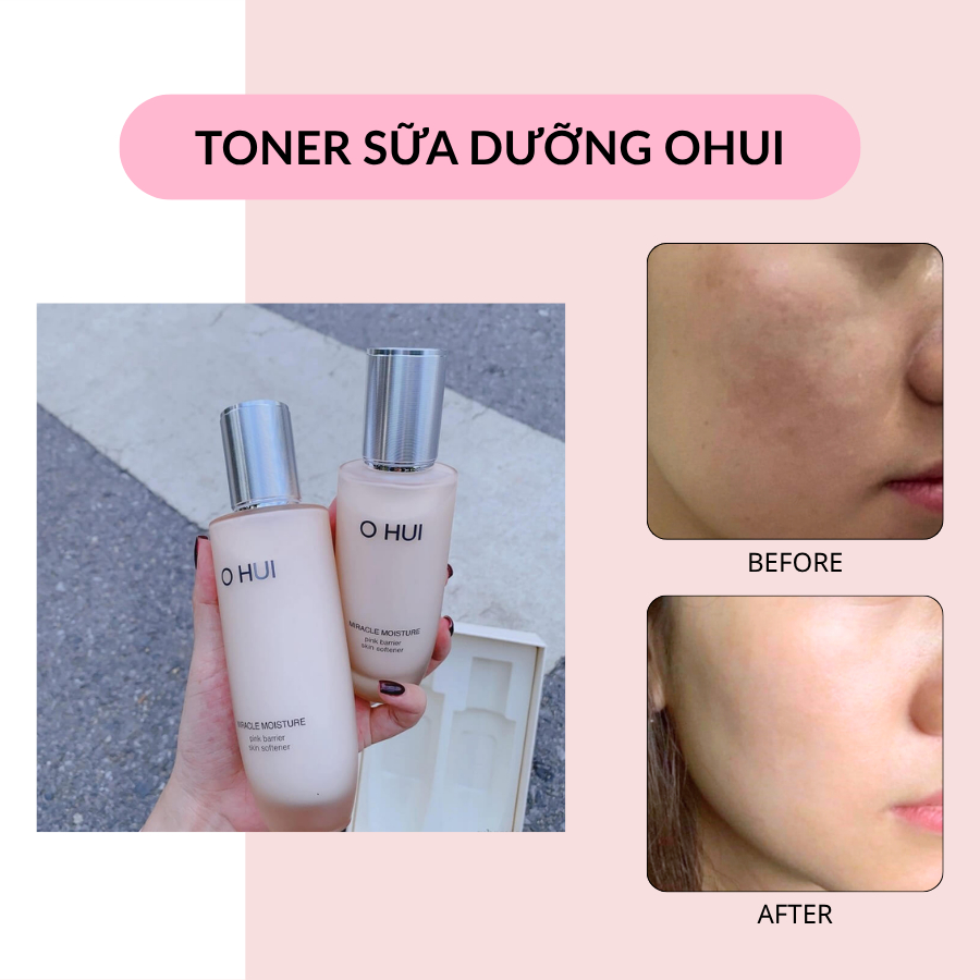 Cặp Nước hoa hồng và Sữa dưỡng OHUI HỒNG dưỡng ẩm cho da khô Miracle Moisture 20ml - AB AUTHENTIC | BigBuy360 - bigbuy360.vn