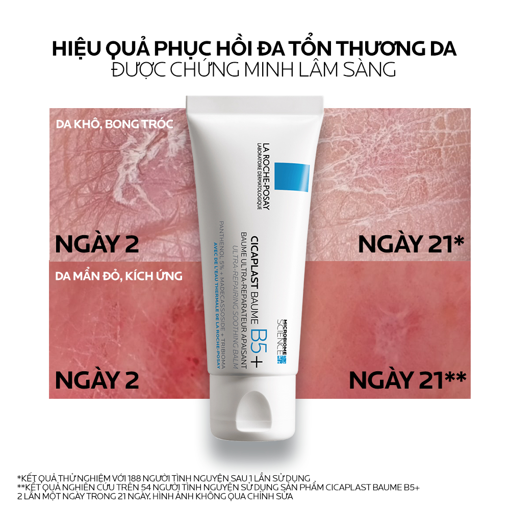 Kem Dưỡng Ẩm & Phục Hồi Đa Năng La Roche-Posay Cicaplast Baume B5+ giúp phục hồi da sau 1 lần sử dụng - phiên bản 100ml | BigBuy360 - bigbuy360.vn