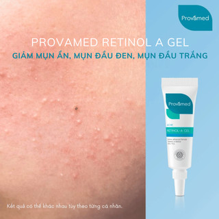  Bộ Chấm Mụn Provamed Chuyên Biệt Cho Mụn Ẩn Mụn Đầu Đen Mụn Đầu Trắng Mụn Viêm Mụn Mủ Mụn Bọc Và Gel Giảm Thâm Mụn 
