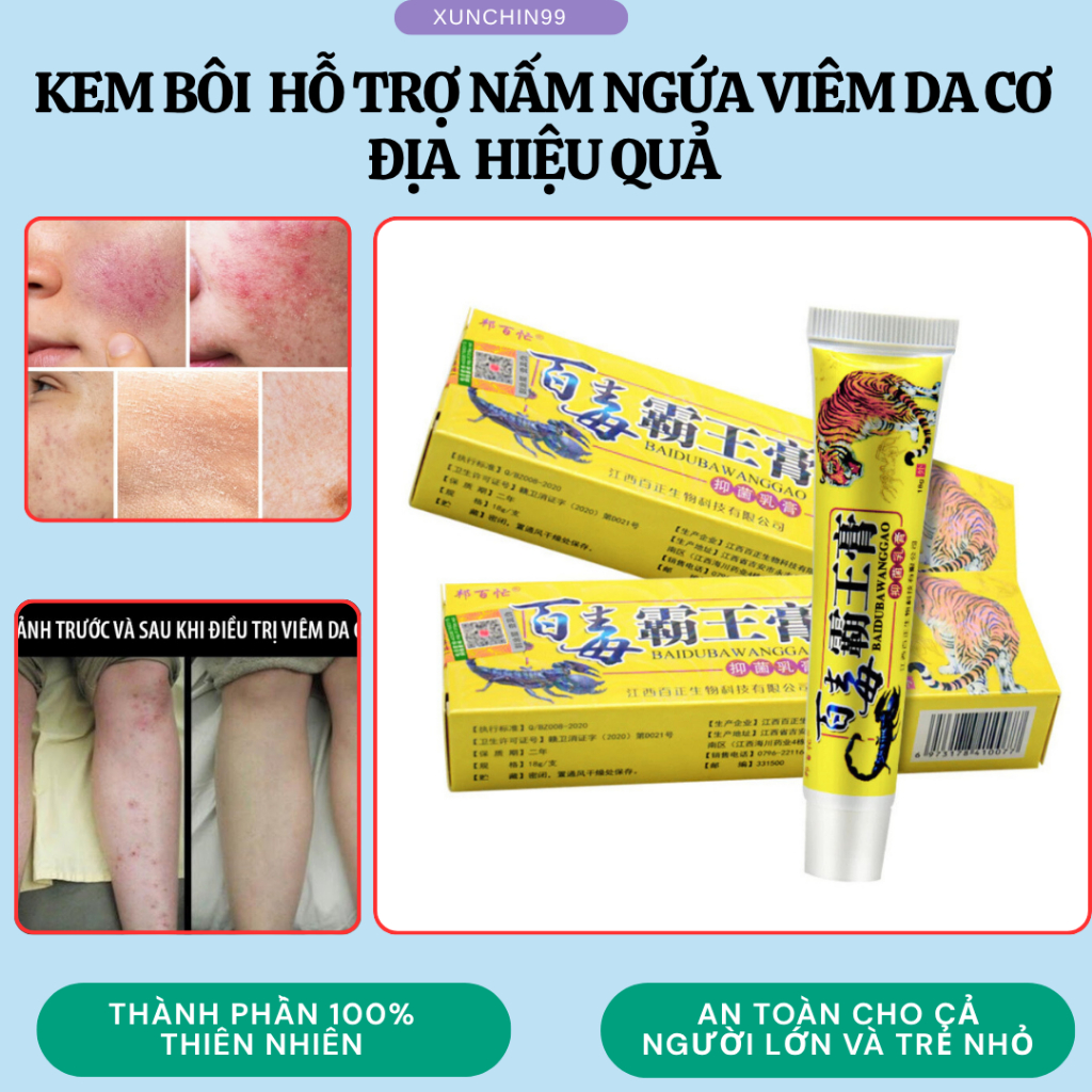 [kem hổ] Kem bôi đông y da liễu Trung Hoa giảm ngứa, chàm, nứt nẻ, vảy nến, á sừng...-xunchin99