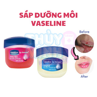  Sáp Dưỡng Môi Vaseline Lip Therapy 7g Dưỡng Ẩm Phục Hồi Bảo Vệ Đôi Môi Khô Nứt Nẻ 
