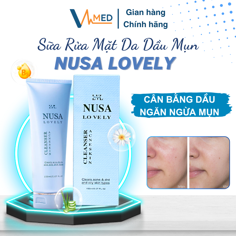 Sữa rửa mặt cho da dầu mụn Nusa Lovely sạch sâu, giảm mụn, cân bằng dầu nhờn trên da