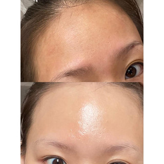 [Mua 1 tặng 1 ] PEEL BHA EMVY BEAUTY