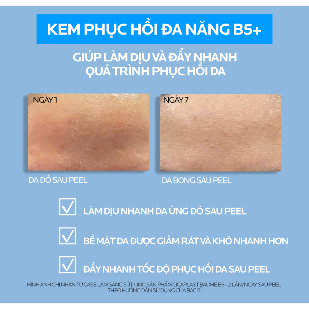 Kem Dưỡng Ẩm & Phục Hồi Đa Năng La Roche-Posay Cicaplast Baume B5+ giúp phục hồi da sau 1 lần sử dụng - phiên bản 100ml | BigBuy360 - bigbuy360.vn