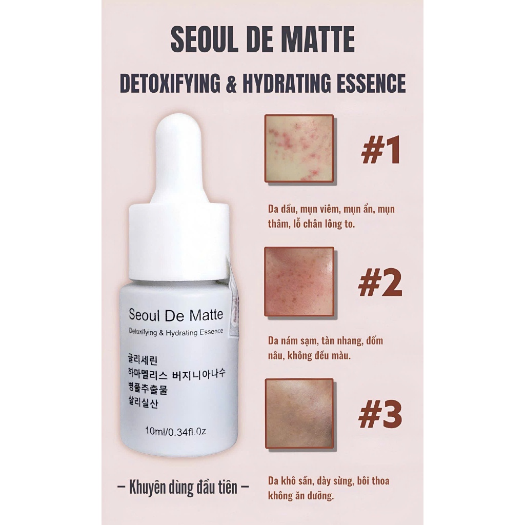 serum detox thải độc seoul matte rose de seoul 10 ml sạch dầu mụn ẩn_hạn dùng 2028
