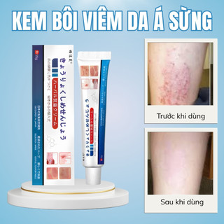 Kem Bôi Nấm Ngứa Vảy Nến Á Sừng Hắc Lào Lang Ben Hiệu Quả, Kem Da Liễu Dứt Điểm Ngứa Ngáy tongkhosi