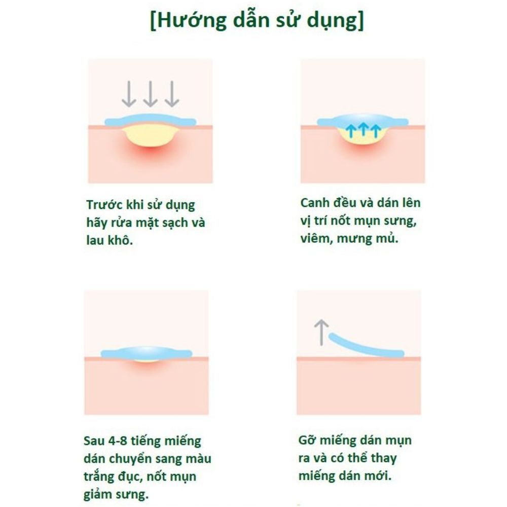 Ảnh 7 của Dán mụn BEABIAI trong suốt, mỏng, vô, hình giảm sưng, bảo vệ da khỏi bụi bẩn