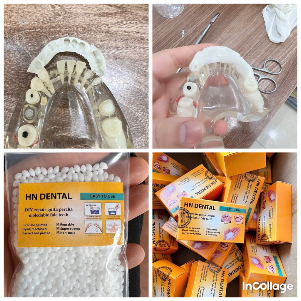 răng nhựa tháo lắp- tự làm tại nhà