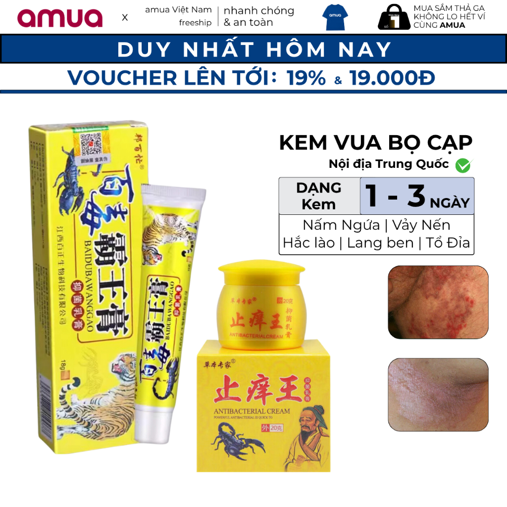 Kem nấm ngứa Vua Bọ Cạp nội địa Trung Quốc - Bôi da liễu đa năng, viêm da, ghẻ nước ăn chân tay ...