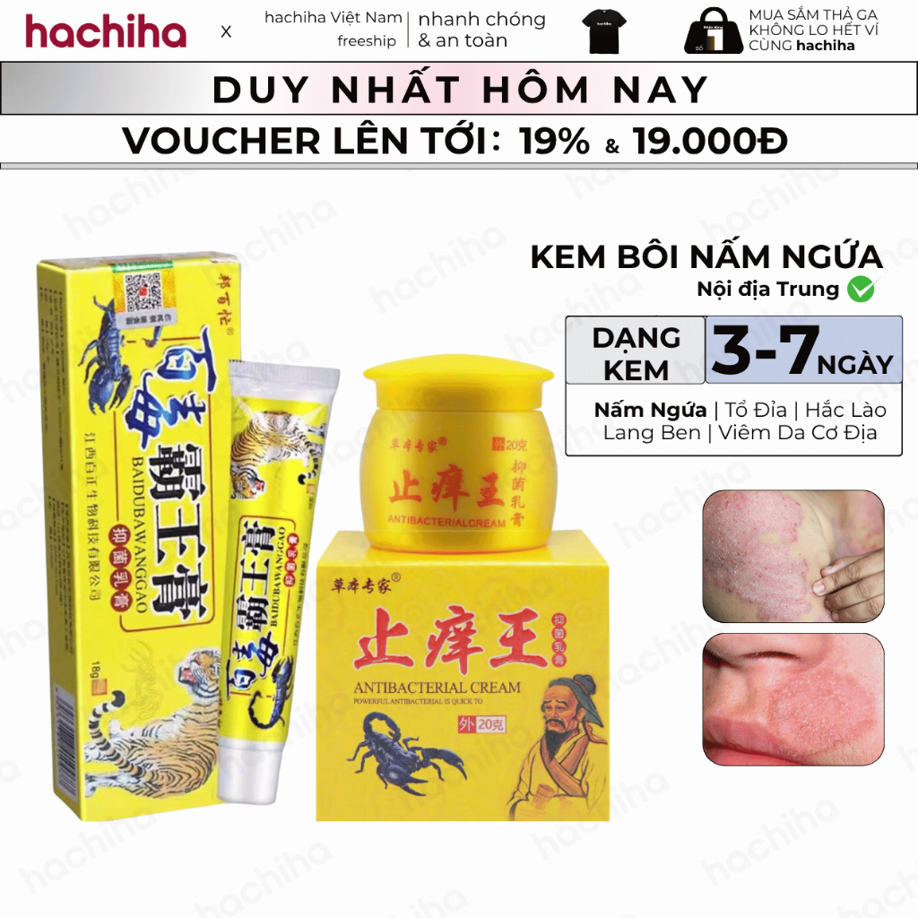 Tuýp Hổ Vàng Bôi Nấm Ngứa, Hắc Lào, Viêm Da Dị Ứng, Vẩy Nến - Hũ Vua Bọ Cạp Vàng