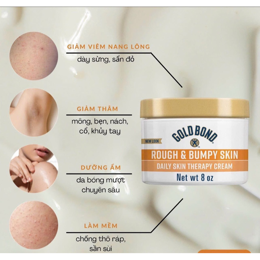 Kem Gold Bond Rough & Bumpy Skin