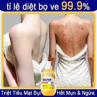  Sữa tắm mụn lưng sữa tắm viêm nang lông sữa tắm lưu huỳnh 500ml Làm sạch sâu bụi bẩn dưới da Cải thiện mụn trứn 