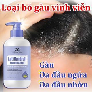  Dầu gội chống ngứa Loại bỏ gàu Giảm ngứa và tiết dầu Viêm da tiết bã nhờn Dầu gội Selenium sulfide 