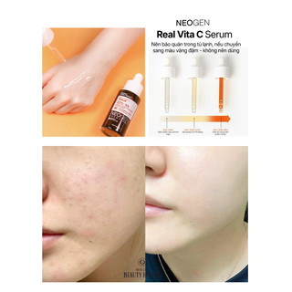 Serum mờ thâm, dưỡng sáng NEOGEN REAL VITA 22% +  5% SERUM