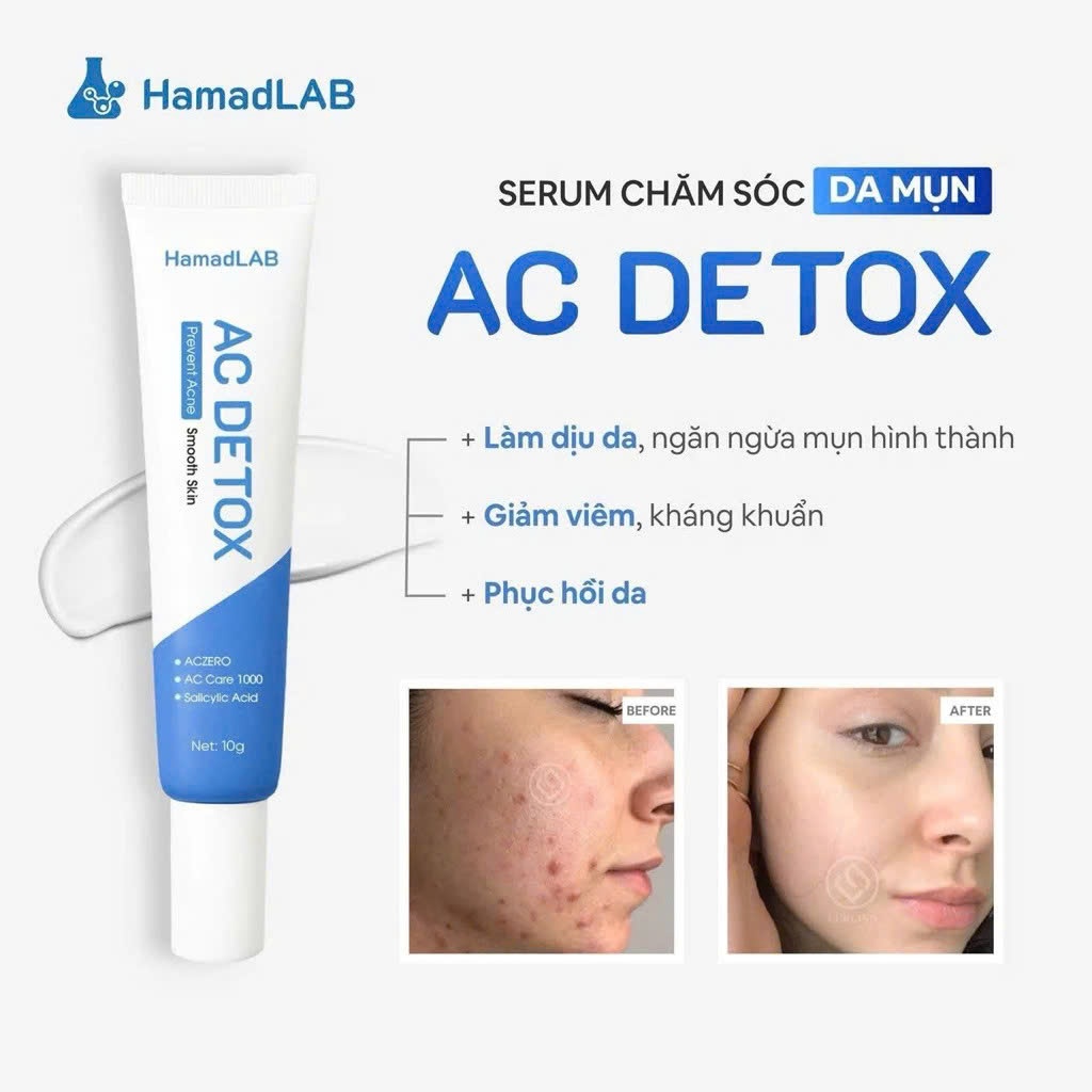 Serum Chăm Sóc Da Mụn Mờ Thâm LURCINN SAPANZI Prevent Acne New - AC Detox HamadLAB 10ml