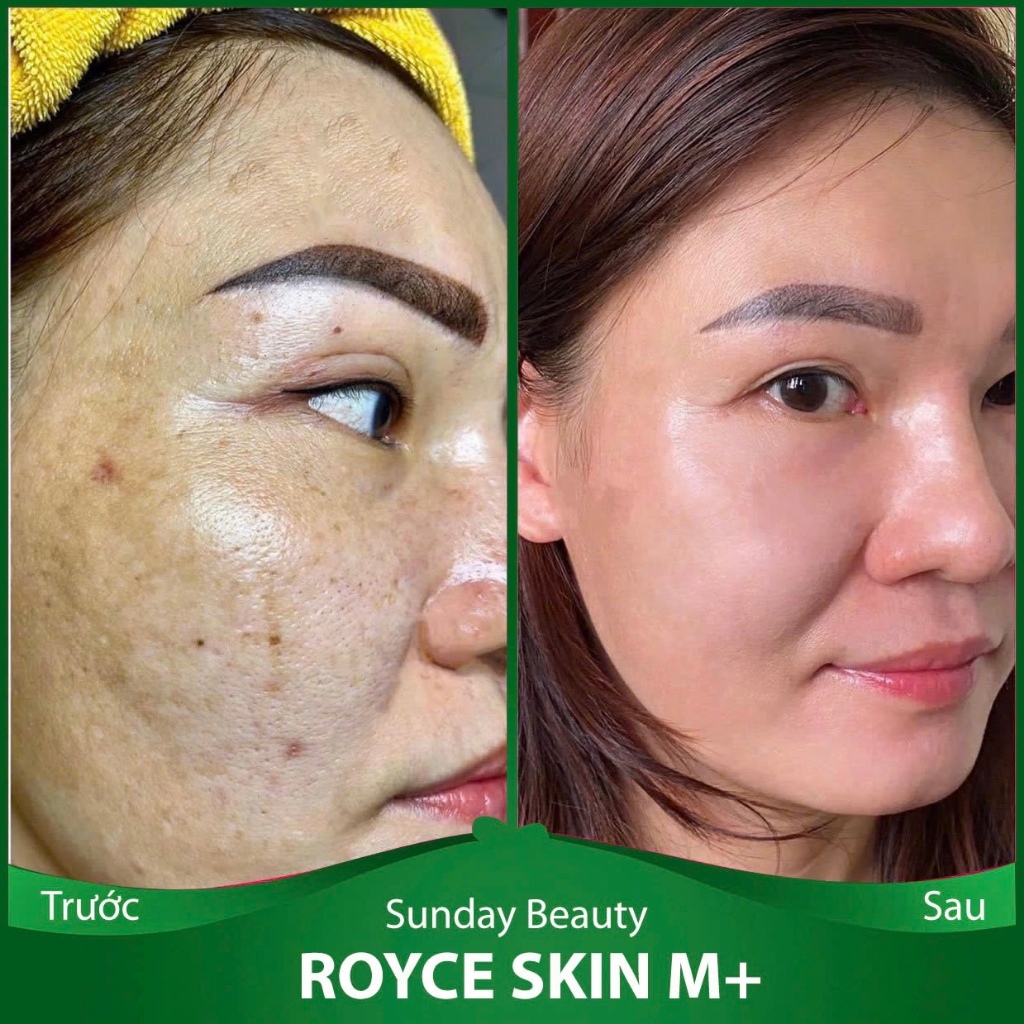 [Peel da] Peel da ROYCE SKIN M+ Peel da tiện lợi dễ sử dụng A22 peel da