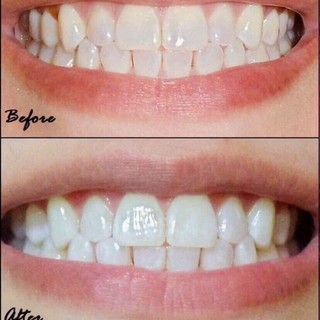 [date 2028] Kem đánh răng Crest 3D White Advanced Triple Whitening 147g