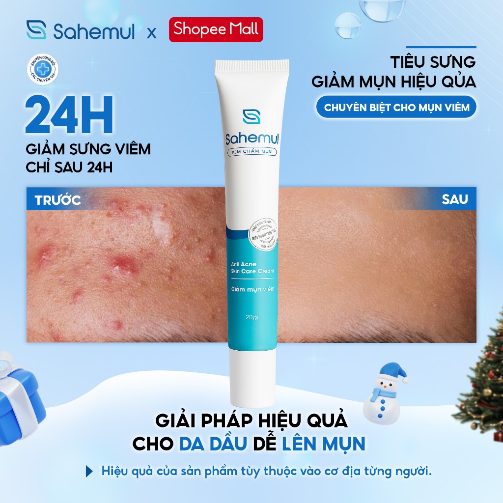 [LIVE KOL] Kem Chấm Mụn Sahemul Giảm Mụn Viêm, Mụn Bọc, Mụn Mủ, Mụn Trứng Cá Hiệu Quả Nhanh 20gr