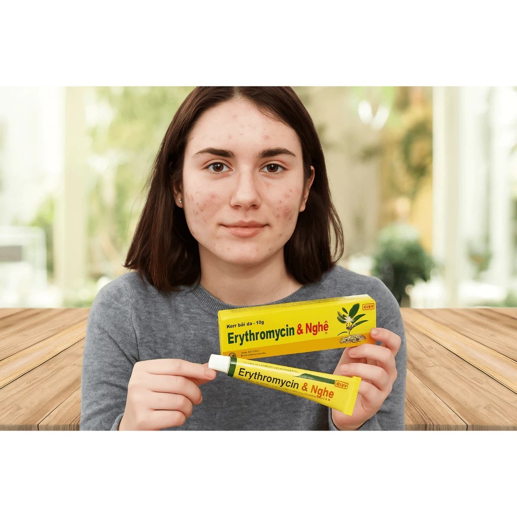 Kem Nghệ, Ngừa mụn Ery Nghệ- Ngừa Mụn,Giảm thâm, Ngừa Sẹo, Từ Tinh Chất Nghệ medipharco Tuýp 10gram