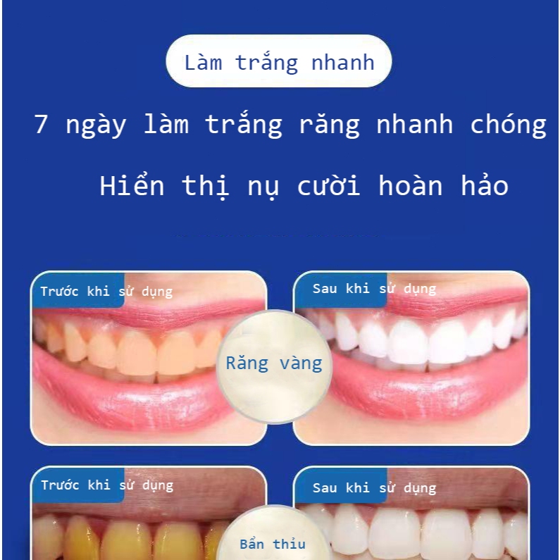 |Dopamine cô gái|Miếng dán trắng răng tiện lợi 5D White Teeth Whitening Strips Làm trắng trắng răng 