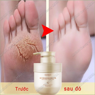  kem tri nút gót chân,Chống Nứt Gót Nẻ Da Tay Làm trắng da Chân Chân á sừng Bong da Dưỡng Ẩm Cải thiện tình trạng khô da 
